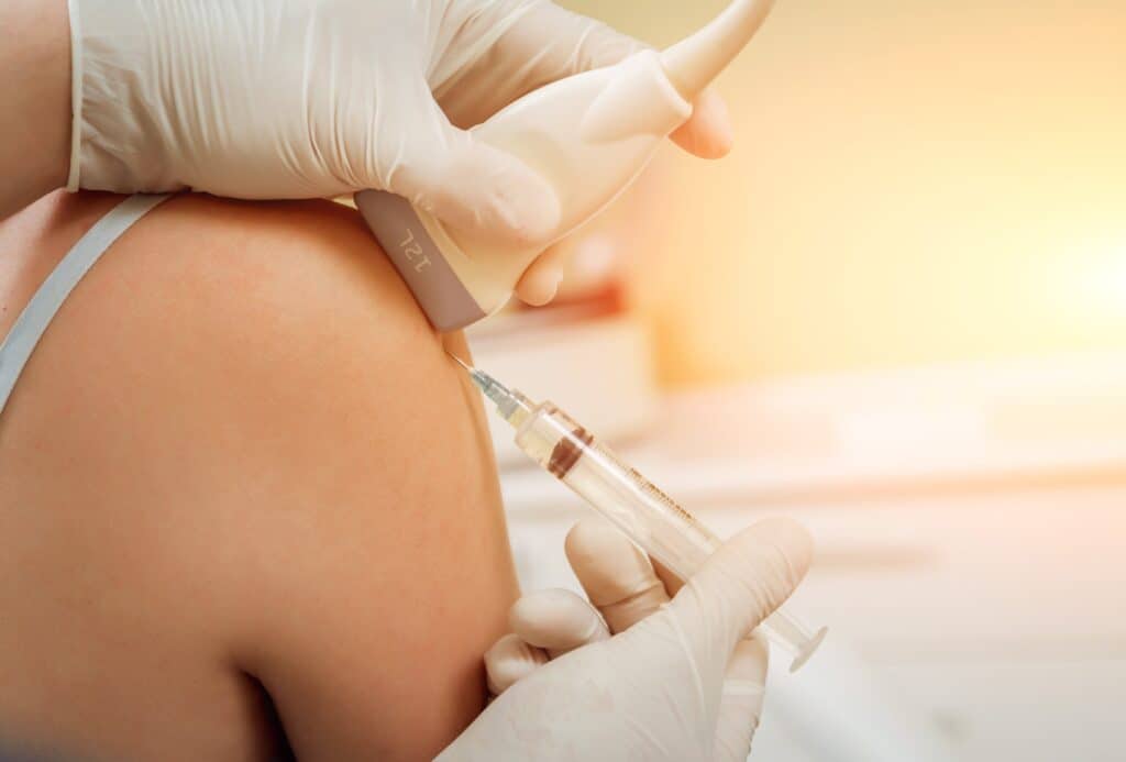 Ultrasound guided steroid injections
